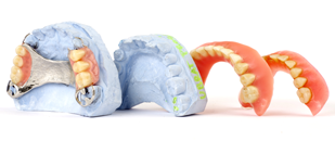 image dentier ou partiel